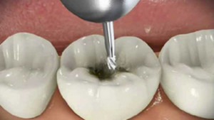 ortodonzia conservativa